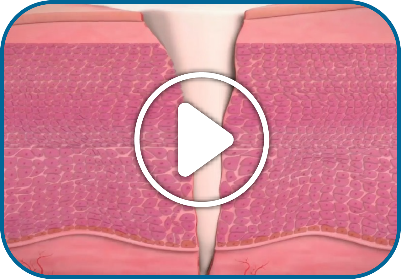 3D Video Preview